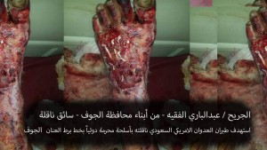 الجريح عبدالباري الفقيه (1)