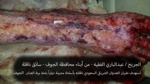 الجريح عبدالباري الفقيه (4)