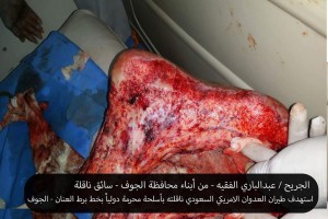 الجريح عبدالباري الفقيه (8)