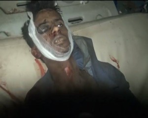 شهداء مدينة المهندسين المخا (12)