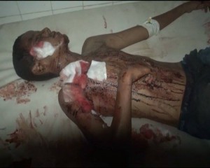 شهداء مدينة المهندسين المخا (4)