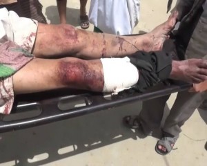 12009823_1469136133393425_9138134024731008965_n