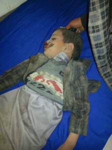 مجازر العدوان بحق أطفال اليمن (11)