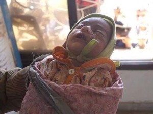 مجازر العدوان بحق أطفال اليمن (2)