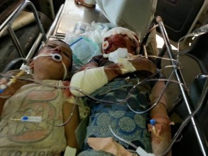 مجازر العدوان بحق أطفال اليمن (3)