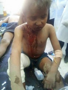 مجازر العدوان بحق أطفال اليمن (4)