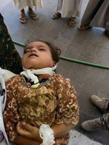 مجازر العدوان بحق أطفال اليمن (5)