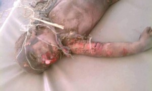 مجازر العدوان بحق أطفال اليمن (8)