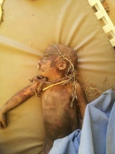 مجازر العدوان بحق أطفال اليمن (9)