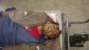 جريمة العدوان باستهداف منزل مواطن في قرية الملحاء-الحدا-ذمار (2)