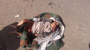 جريمة العدوان باستهداف منزل مواطن في قرية الملحاء-الحدا-ذمار (4)