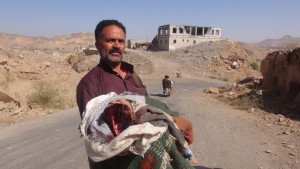 جريمة العدوان باستهداف منزل مواطن في قرية الملحاء-الحدا-ذمار (5)