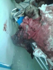 جريمة العدوان باستهداف منزل مواطن في قرية الملحاء-الحدا-ذمار (7)