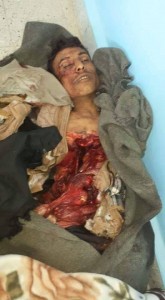 جريمة العدوان باستهداف منزل مواطن في قرية الملحاء-الحدا-ذمار (8)