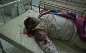 جريمة العدوان في حوث (8)