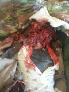 شهداء غارة للعدوان على مستشفى اطباء بلا حدود صعدة 2