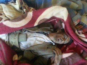 شهداء غارة للعدوان على مستشفى اطباء بلا حدود صعدة