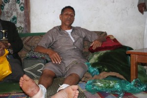 قنابل عنقودية - صنعاء (3)