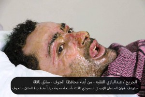 الجريح عبدالباري الفقيه (2)