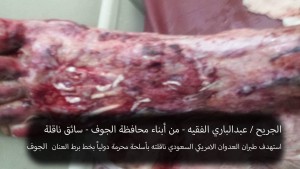 الجريح عبدالباري الفقيه (7)