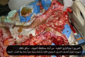 الجريح عبدالباري الفقيه (9)