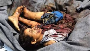 مجزرة قطابر صعدة الثلاثاء 9أ غسطس 2016-3