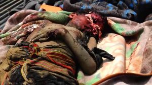 مجزرة قطابر صعدة الثلاثاء 9أ غسطس 2016-7