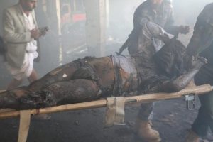 %d9%85%d8%ac%d8%b2%d8%b1%d8%a9-%d8%a7%d9%84%d8%b9%d8%b2%d8%a7%d8%a1-%d9%81%d9%8a-%d8%a7%d9%84%d8%b5%d8%a7%d9%84%d8%a9-%d8%a7%d9%84%d9%83%d8%a8%d8%b1%d9%896