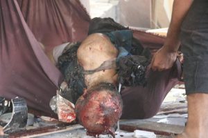 %d9%85%d8%ac%d8%b2%d8%b1%d8%a9-%d8%a7%d9%84%d8%b9%d8%b2%d8%a7%d8%a1-%d9%81%d9%8a-%d8%a7%d9%84%d8%b5%d8%a7%d9%84%d8%a9-%d8%a7%d9%84%d9%83%d8%a8%d8%b1%d9%897